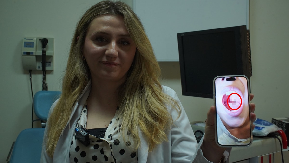 Burun kanamasıyla hastaneye gitti, boğazından çıkan şey doktorları bile şaşırttı - Görsel 4